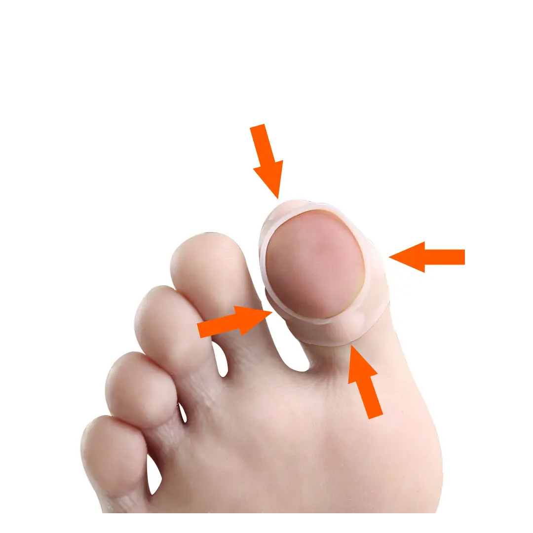 Nageltrång silikonskydd